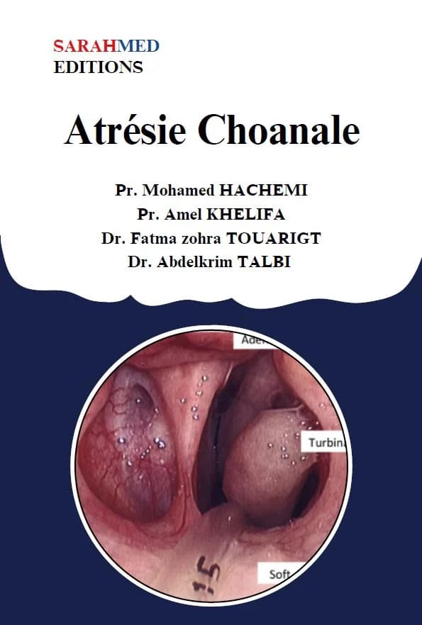 Atrésie Choanale