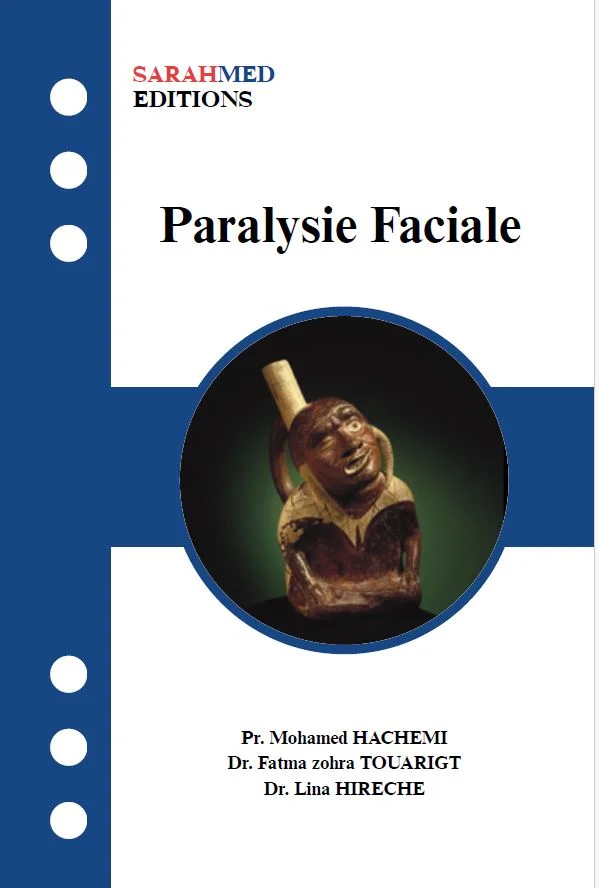 PARALYSIE FACIALE